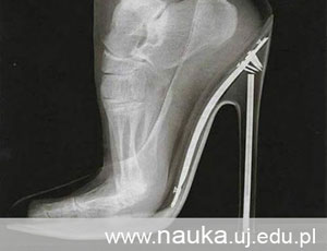 1Question: What happens to our feet when we wear high heels?