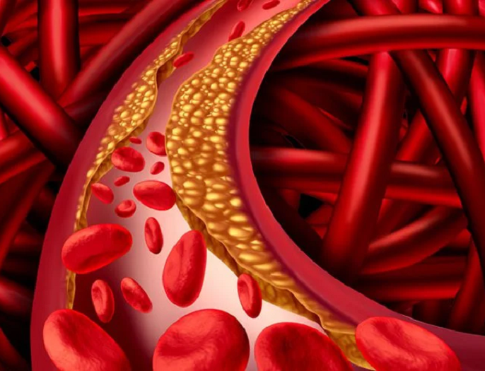 How the brain controls atherosclerosis